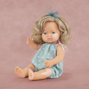 Boneca com Vitiligo - 38 cm